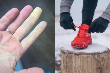 how-to-exercise-outside-with-raynaud’s-syndrome-without-freezing-your-fingers-off